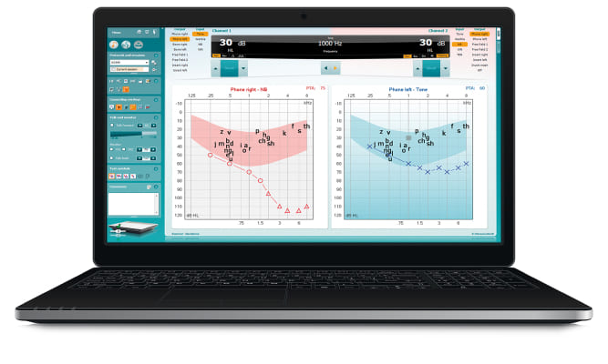 equinox laptop audiometry 1