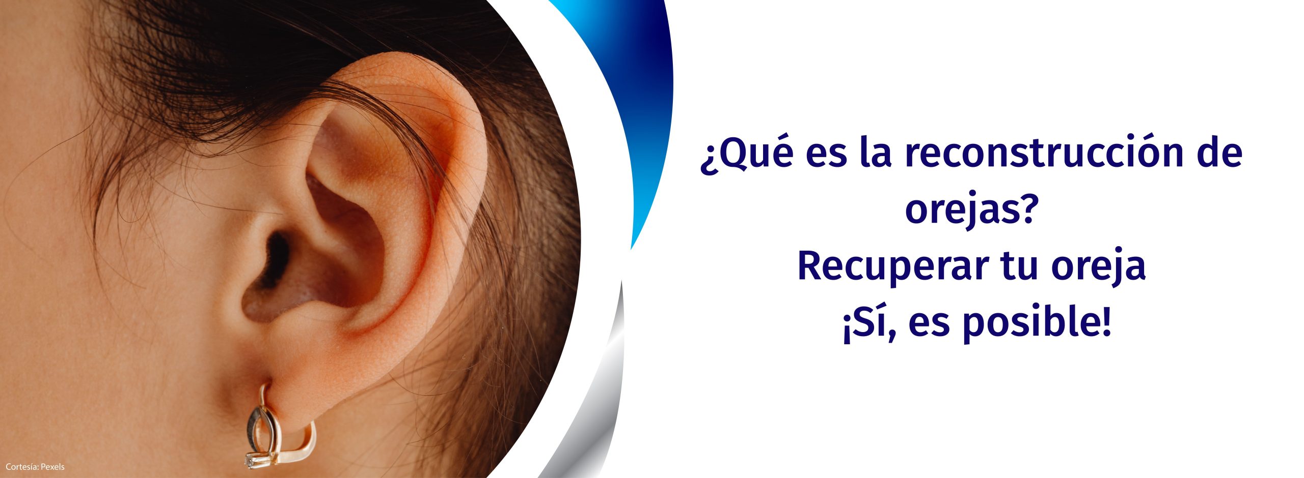 reconstruir oreja