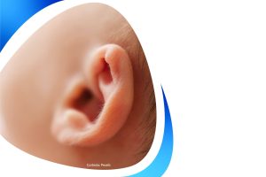 sistema epipliating